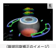 眼球回旋の補正